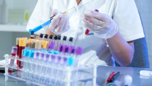 עבודה עם נוזלי גוף